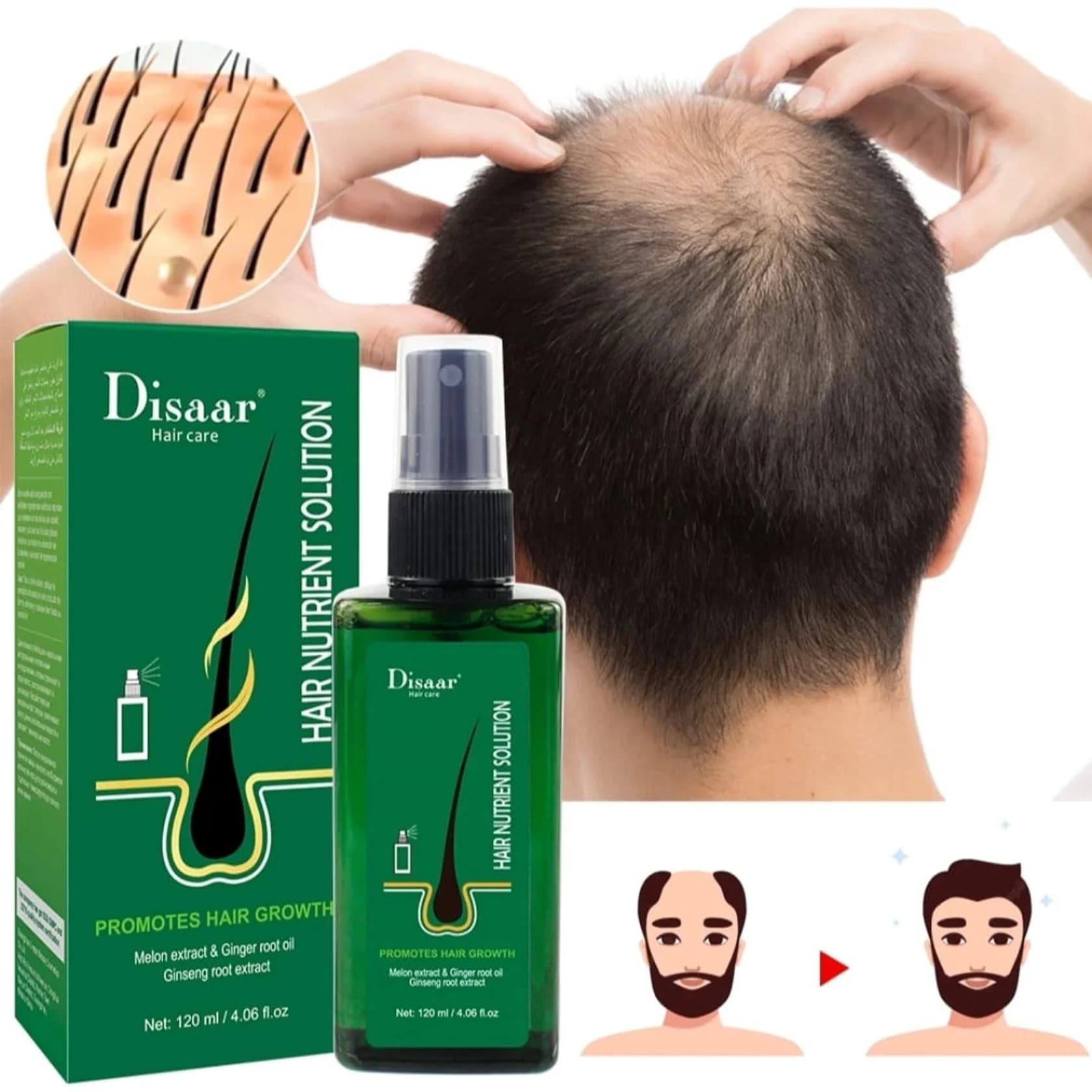 Saç uzadan yağ Disaar Hair Growth, 120 ml — изображение 3