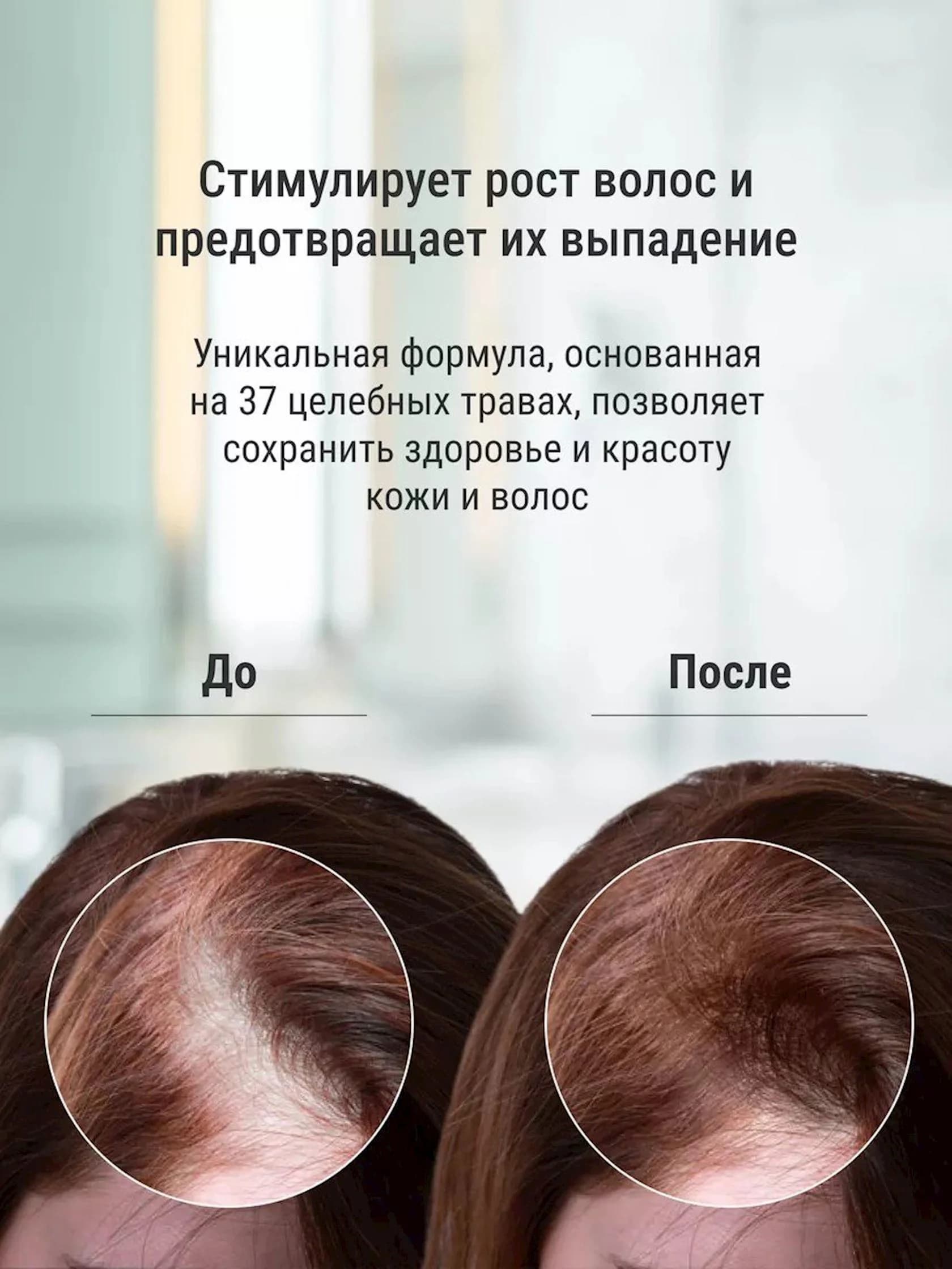 Saç üçün sərt sabun-şampun Polygonum Multiflorum Shampoo Soap, saçların tündləşməsi üçün, saçların uzanmasına və saç tökülməsinin qarşısını almaq üçün, 100 q — şəkil 11