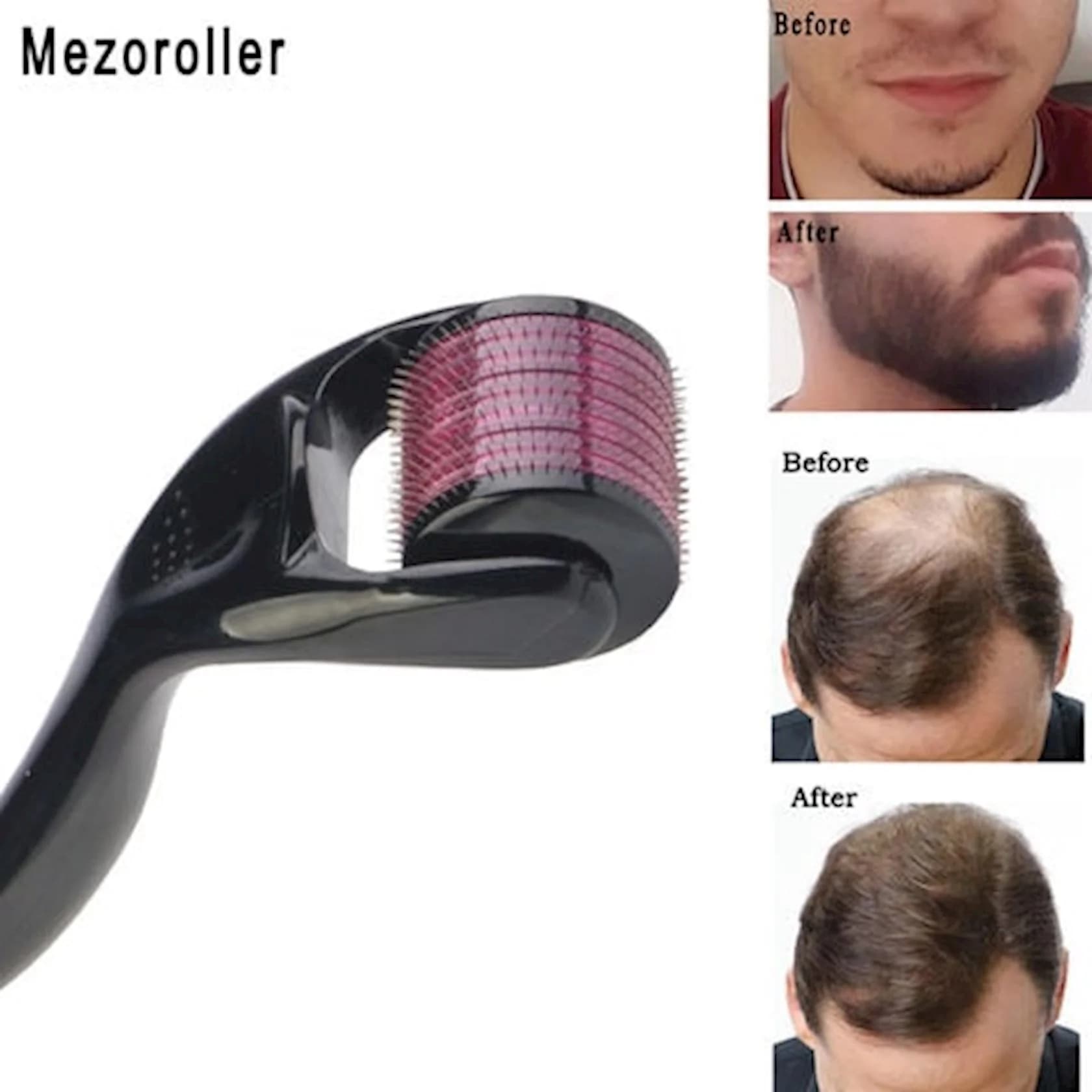Mezoroller üz və bədən üçün DRS Derma Roller, 540 iynəli (6902540752583) — изображение 2